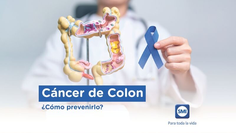 imagen de Cáncer de colon - Información de interés